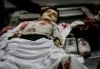أستاذ قانون دولي لشهاب: 21 ألف طفل شهيد في غزة.. رقم يستدعي تحقيقًا جنائيًا دوليًا