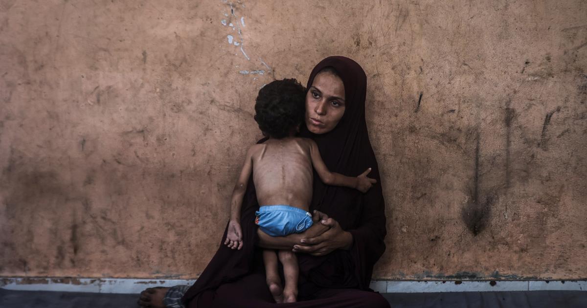 فلسطين – تقرير: أطفال غزة يقتلون بـ”الشوكولاتة”.. وحالات سوء التغذية تتصاعد ضمن سياسة هندسة التجويع