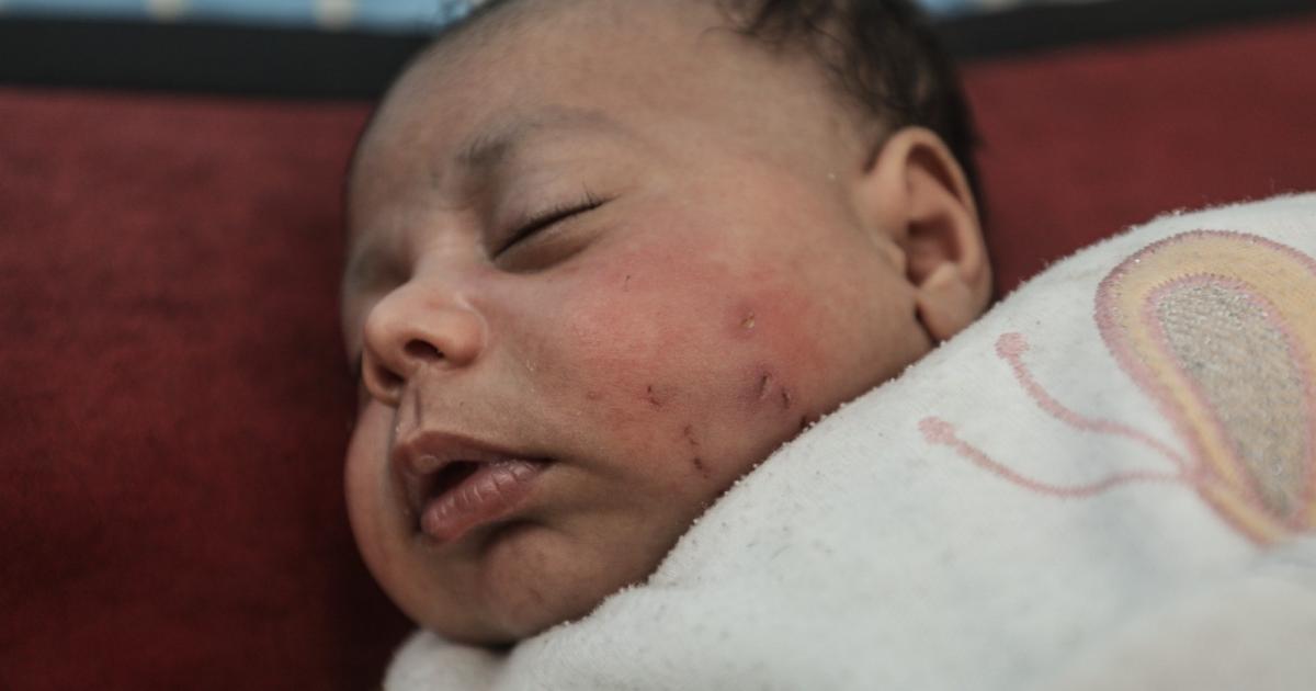 فلسطين – رئيس بلدية غزة يحذر من “كارثة بيئية” بسبب تفاقم أزمة القوارض والحشرات ونقص مواد المكافحة