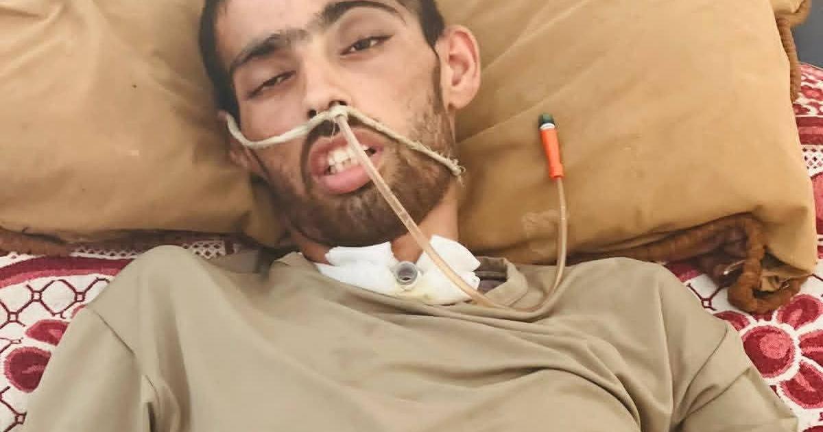 فلسطين – تقرير محمد أبو طه.. جريح بين الحياة والموت في ظل انهيار النظام الصحي في غزة