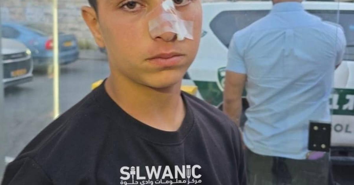 فلسطين – إصابة طفل بهجوم مستوطنين في بلدة سلوان فلسطين – إصابة طفل بهجوم مستوطنين في بلدة سلوان
