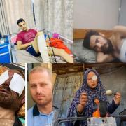 قصص جرحى غزة تكشف حجم الانهيار الطبي في القطاع