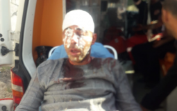 صورة لمواطن أصيب بهجوم للمستوطنين