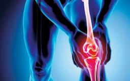 الفصال العظمي