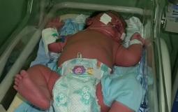 امرأة برازيلية تُنجب طفلاً ضمن أضخم المواليد في العالم!