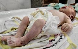 وفاة-رضيعة-تجمدت-من-البرد-في-خيام-النازحين-بغزة