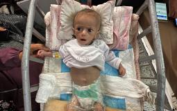 طفلة من غزة تعاني من سوء تغذية حاد نتيجة إغلاق الاحتلال للمعابر منذ أكثر من شهرين