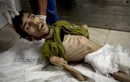 "أيوب".. الشاب الذي صبر حتى هزمه الجوع وأنهى حياته!