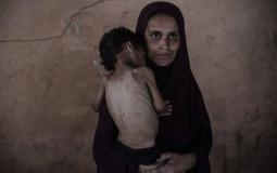 المجاعة تضرب غزة بلا رحمة.. جوعٌ ينهش الأجساد وأرواح تزهق وصراخ الأطفال لا يهدأ