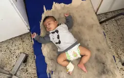 ازدياد غير مسبوق لحالات الحمى الشوكية في غزة ونحذر من مضاعفات خطيرة