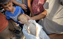 طفل استشهد بعد إصابته بسوء التغذية في قطاع غزة