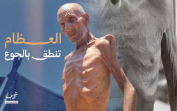 المسن سليم عصفور نازح في خان يونس ويعاني من سوء التغذية بسبب الحصار الإسرائيلي المستمر