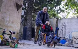 الطفل محمد أبو محسن فقد عائلته وإحدى عينيه يبحث عن أمل بالعلاج في الخارج