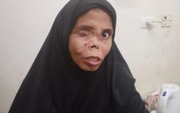 الجريحة نجوى عطيوي