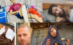 قصص جرحى غزة تكشف حجم الانهيار الطبي في القطاع