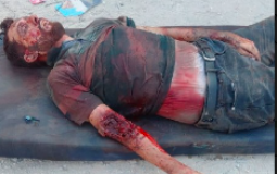 4 شهداء وإصابات بقصف الاحتلال في جباليا شمال قطاع غزة