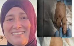 الشهيدة أم محمد العرابيد