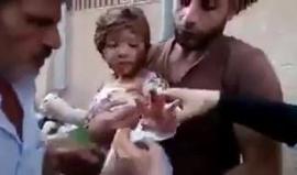 الطفل وشقيقته استشهدا حرقا بالقصف ببراميل متفجرة تحوي مادة النابالم الحارقة والمحرمة دوليا ! 
#حمص #سوريا