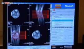 الصيام مفيد لمرضى الروماتيزم