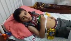 فيديو - رصد تأثير نقص الأدوية والكهرباء باحدى مشافي خانيونس جنوب قطاع غزة