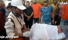 #شاهد مراسل شهاب: توالي وصول عدد من الاصابات لمستشفى شهداء الأقصى وسط قطاع غزة، من بينهم مسعفون وصحفيون.