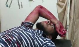 #شاهد النظام يقصف ريف حمص ويوقع قتلى وجرحى بينهم أطفال