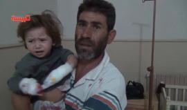 #شاهد طفلة صغيرة بترت أصابع يديها إثر إصابتها بشظايا إحدى الغارات الجوية على قرية الفرحانية غرب مدينة تلبيسة بريف حمص