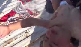 #خان_شيخون_تختنق
#إدلب #سوريا #كيماوي_الأسد