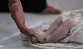 صورة تعبيرية