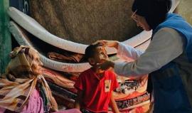 التهاب الكبد الفيروسي يجتاح خيام النازحين مع تفاقم أزمة المياه والمنظومة الصحية