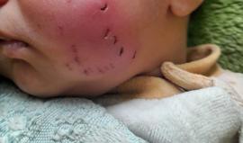 الرضيع آدم الأستاذ