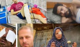 قصص جرحى غزة تكشف حجم الانهيار الطبي في القطاع