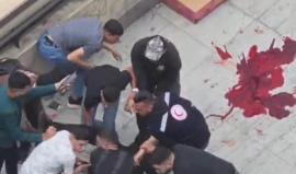 شهيد و4 إصابات برصاص الاحتلال خلال اقتحام نابلس