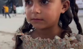 "طفولة بعمر الـ 5 أعوام وتعيش مع 5 إصابات".. هذه شام بدأت الحرب وهي بعمر الثلاثة أعوام، وأصيبت خلال حرب الإبادة الجماعيَّة 5 مرات، تعدّهم على أصابعها الصغيرة بالمكان وموضع الإصابة