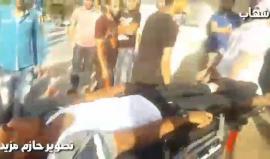 #شاهد لحظة وصول شاب مصاب لمستشفى شهداء الأقصى وسط قطاع غزة
تصوير: حازم مزيد