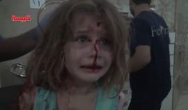 مشهد مؤلم لطفلة سورية أصيبت بالقصف على مدينة #تلبيسة بريف #حمص الشمالي