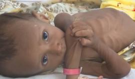 تقرير مؤثر: يونيسيف تحذر من الأخطار الصحية المحدقة بـ5 ملايين طفل #اليمن