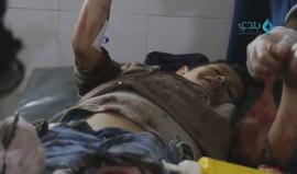 مشاهد قاسية.. شهداء وجرحى أطفال بقصف مدفعي لقوات النظام على مدرسة في بلدة جسرين بريف دمشق