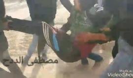 #شاهد من الإصابات برصاص الاحتلال في مواجهات اليوم على السياج الفاصل شرق بيت لاهيا شمال قطاع غزة .