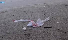 ضحايا جراء قصف قوات الأسد على مدينة #دوما بريف #دمشق