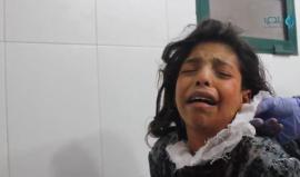 طفلة سورية تبكي بعد إصابتها بقصف جوي على بلدة النشابية في ريف دمشق