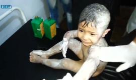 طفل سوري من بين ضحايا القصف بقنابل النابالم الحارقة والمحرمة دولياً في #حي_الوعر المحاصر بـ #حمص 
(مشاهد قاسية +18)