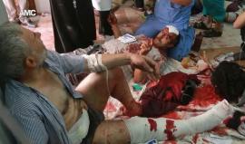 مشاهد قاسية .. ينصح عدم مشاهدة الأطفال +18 
 13 شهيد و75 مصاب جراء قصف بالقنابل العنقودية على حي بستان القصر في #حلب
#هولوكوست_حلب
 #HolocaustAleppo