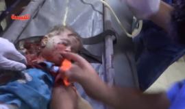 #شاهد مجزرة تستهدف أطفال مدينة تلبسية في ريف حمص الشمال ارتكبها الطيران الحربي