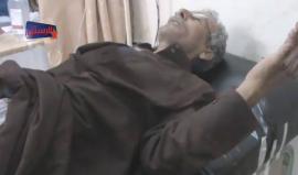 رجل سوري أصيب بالقصف الجوي على مدينة #الرستن بريف #حمص الشمالي