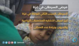 #شاهد 1600 حالة سرطان جديدة يتم اكتشافها سنويا في قطاع غزة