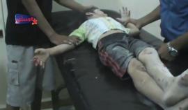 أحد الأطفال المصابين جراء الغارات التي استهدفت مدينة الرستن صباح اليوم !