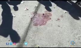 فيديو من مكان إصابة الشاب محمد عامر من مدينة طولكرم برصاص الاحتلال في بلدة حوارة جنوب نابلس صباح اليوم