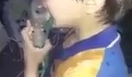 #شاهد أحد الأطفال المصابين من الكيماوي الذي قصفت فيه دوما بالغوطة الشرقية في سوريا.