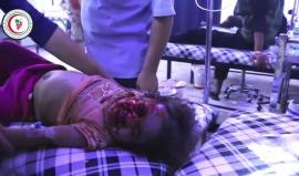 جرحى جراء الغارات المتواصلة على مدينة #دوما بريف #دمشق